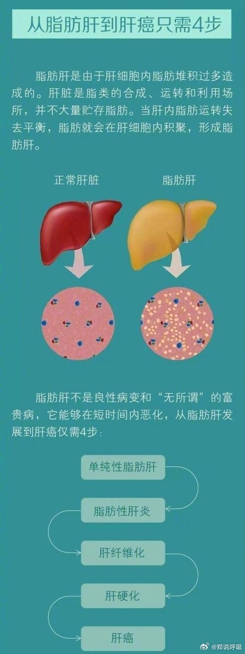 男子为治脂肪肝过度节食致脂肪暴增